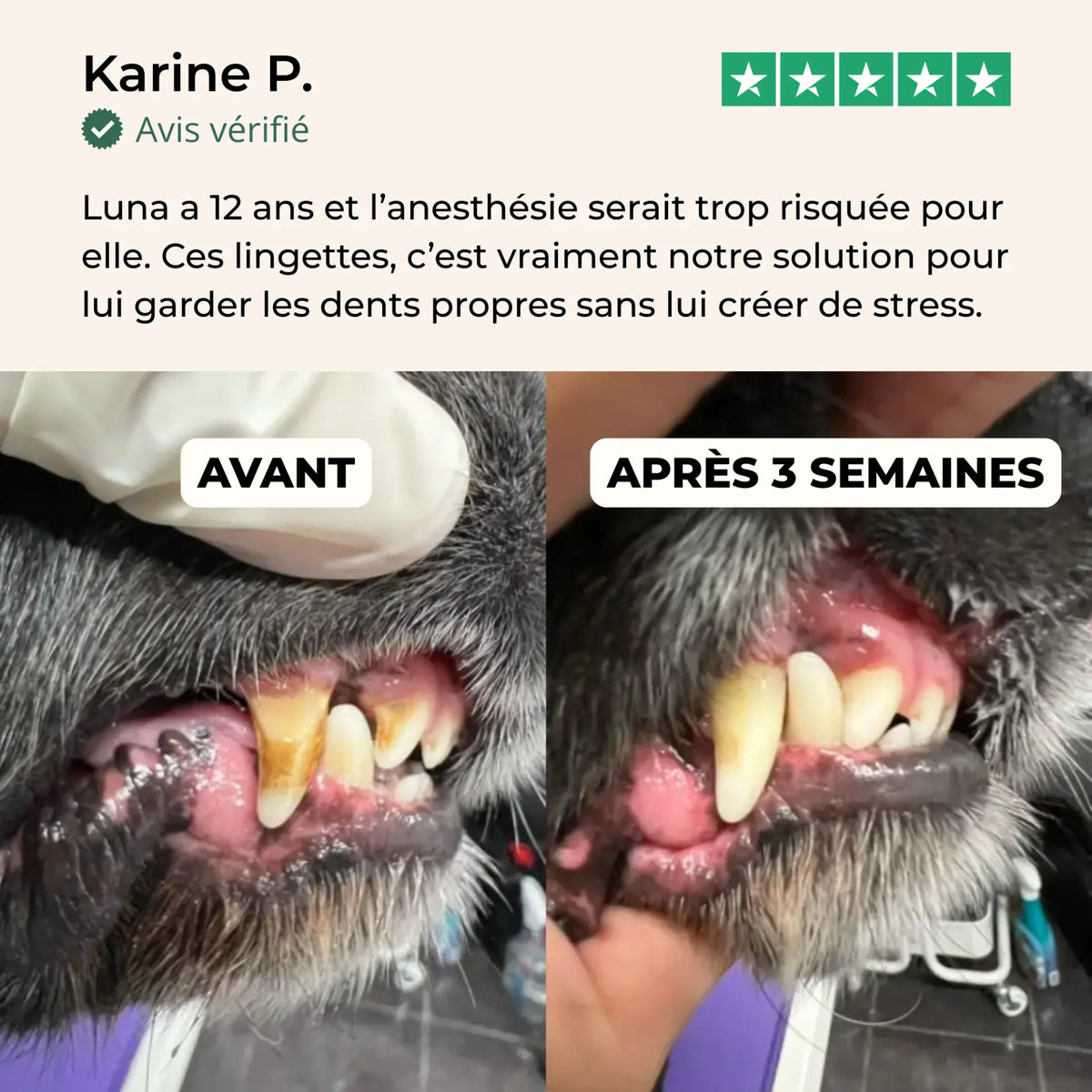 Lingettes Dentaires Anti-tartre